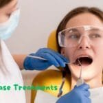 Gum Disease Treatments: A Comprehensive Guide to Maintaining Optimal Oral Health