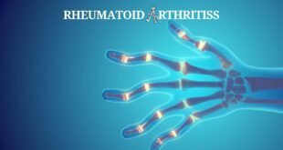 Understanding Rheumatoid Arthritiss: A Comprehensive Guide