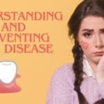 Understanding and Preventing Gum Disease