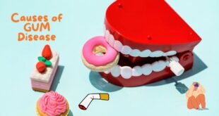 Causes of Gum Disease: An In-depth Exploration