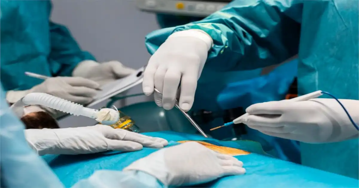 martius flap transect which vessel: Understanding Which Vessel is Involved in the Procedure