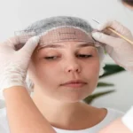How Long Is PDO Eyebrow Lift Recovery Images Right After Explained